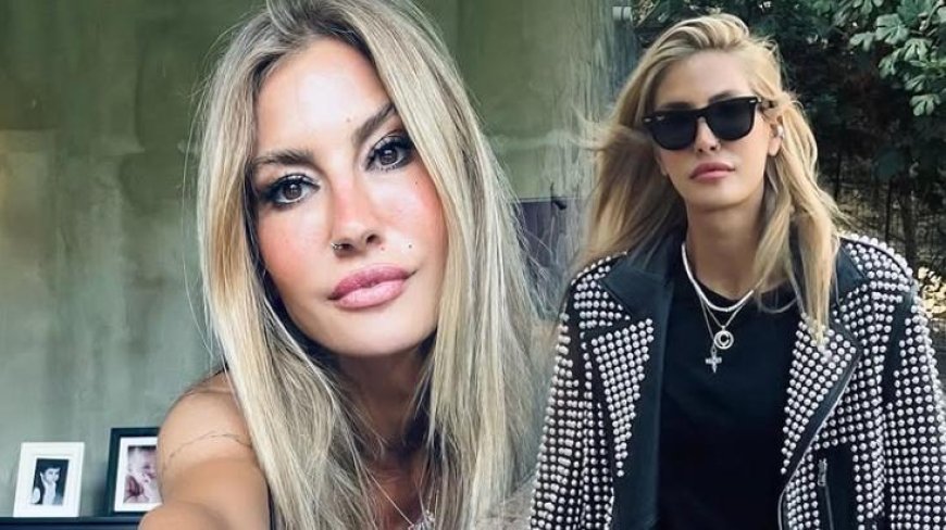 Çağla Şıkel'in bacakları mosmor oldu! Nedeni ise yeni hobisi: En güzel yaz