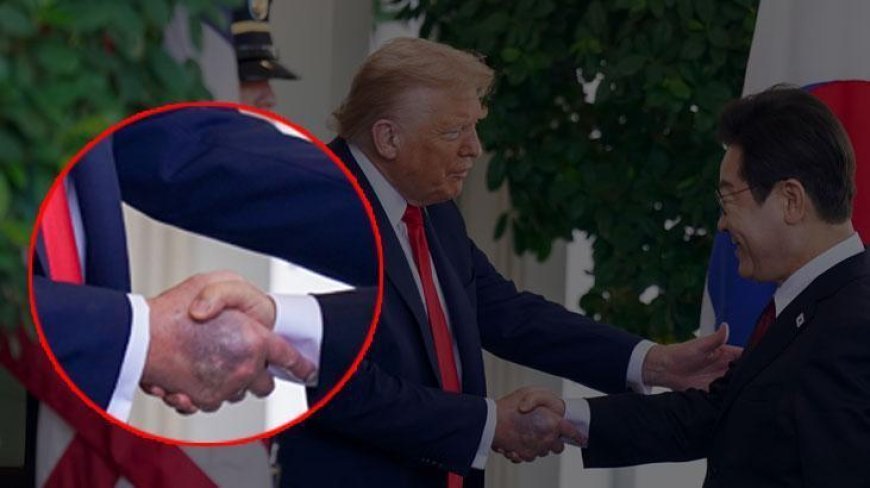 Trump'ın elindeki morluk hakkında Beyaz Saray'dan açıklama