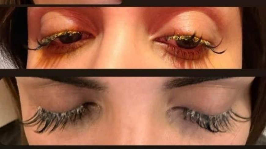 Kirpiklerini yaptırmaya gitti, gözüne yapıştırıcı kaçtı! "Gözlerim göremez hale geldi"