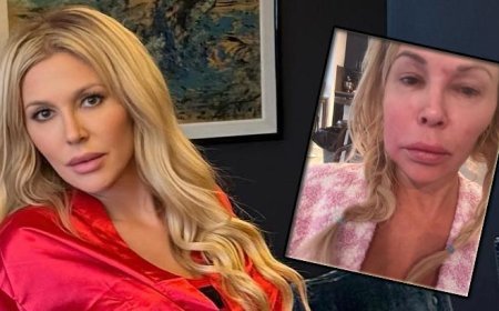 Yüzü eriyordu! Gizemli hastalığın sırrı ortaya çıktı