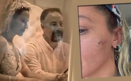 Son Dakika: Yıldız Asyalı'dan şoke eden iddia! 'Kocam tarafından darp edildim'