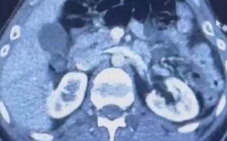 Üç İranlı röntgene girince yakayı ele verdi