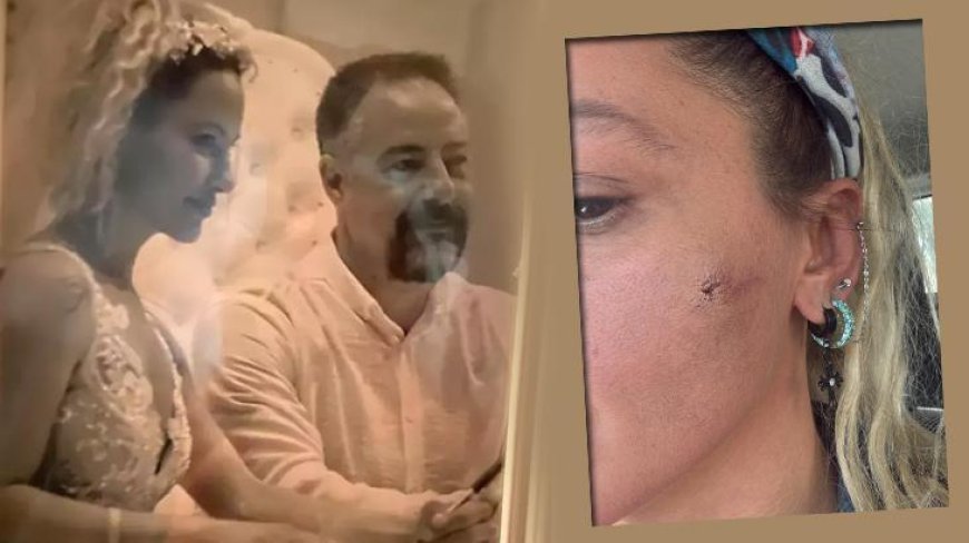 Yıldız Asyalı eşi Mustafa Semih Demirci'den şiddet mi gördü? - Yıldız Asyalı kimdir, kaç yaşında?