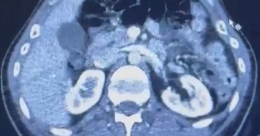 Üç İranlı röntgene girince yakayı ele verdi