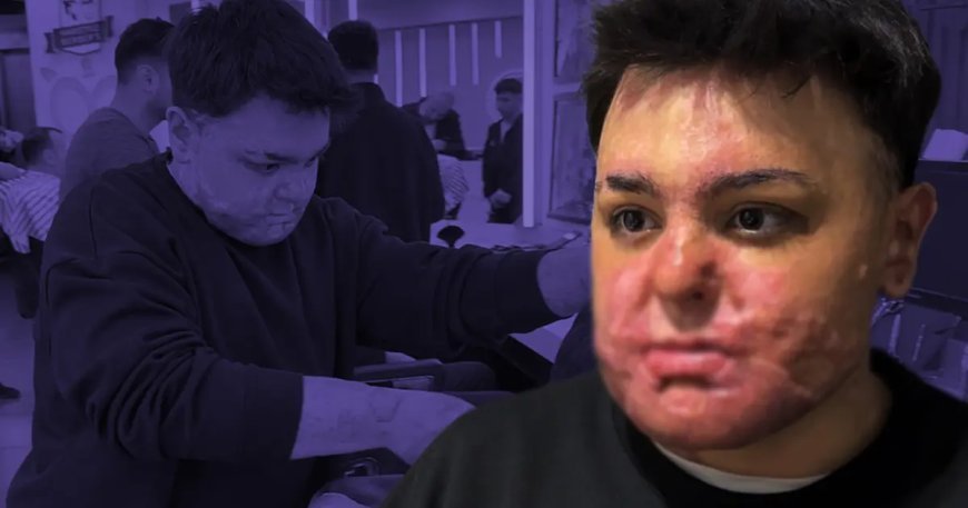 65 ameliyat geçirdi, 12 gün uyutuldu. Felaketi yaşadığı yerde şimdi çalışıyor