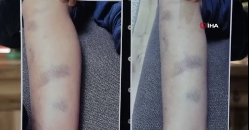 Diyarbakır'da özel okulda öğrenciye dayak iddiasına soruşturma