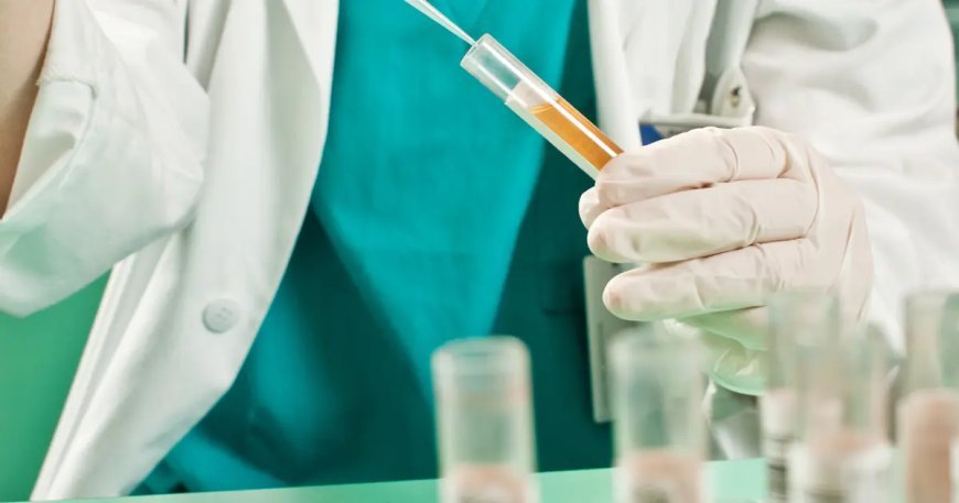 Uyuşturucu testiyle ilgili efsaneler ve gerçekler. Saç boyama, suç içmek, detoks sonuç verebilir mi?