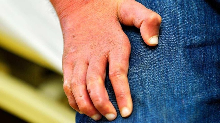 44 yıl sonra ortaya çıktı! Avrupa'da panik: Belirtileri his ve sinir kaybı...