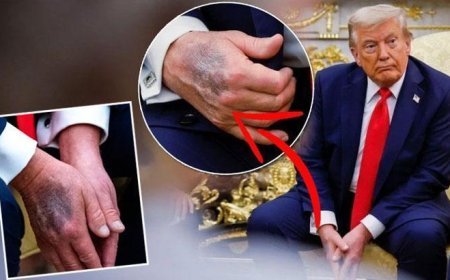 Trump elindeki morlukların sebebini açıkladı! Çeşitli söylentiler vardı
