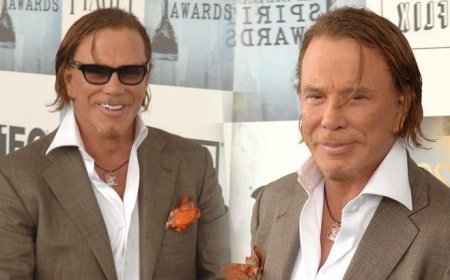 Bir dönemin efsanesiydi! Mickey Rourke artık tanınmaz halde