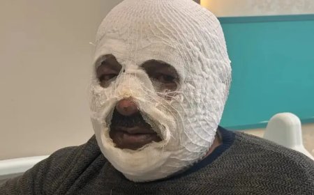 Sular dondu, ateşi hızlandırmak istedi: "Ben yandım kimse yanmasın"