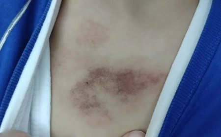 İBB kreşinde çocuğa şiddet ve istismar iddiası. Bakanlık açıklama yaptı