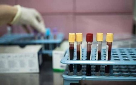 SON DAKİKA HABERLER: Vücutta kansere doğal kalkan! 25 yıllık takip sonuç verdi: İlaca gerek kalmayacak mı?