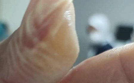 5 dakika geçti patladı, vücudunun yüzde 30'u yandı. Kâbusu yaşadı, acı içinde kaldı