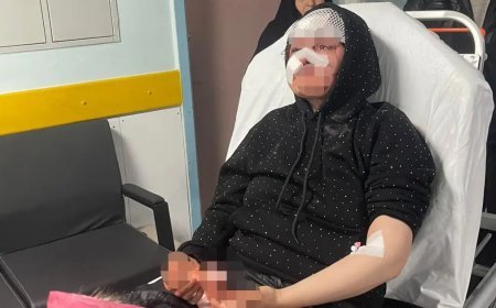 Boşanmak isteyen kadına adliye önünde saldırı. Yoğun bakıma alındı