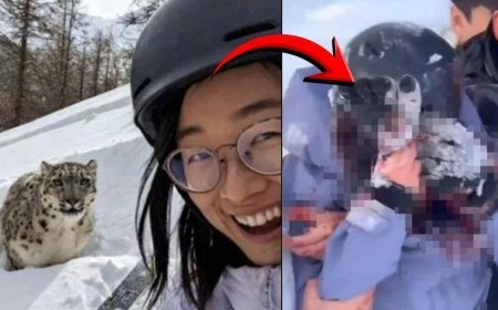 SON DAKİKA HABERLER: 'Selfie' uğruna yüzü paramparça oldu! Mucize kurtuluş