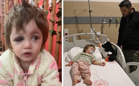 Yalova'da 14 aylık kızı ile birlikte darbedilen babadan yeni açıklama