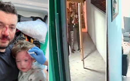 Yalova'da 14 aylık bebeğe saldırı: Olayı bu kamera kayıtları çözecek