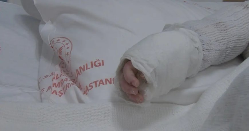 Üzerine kaynar su dökülen 20 aylık bebek taburcu edildi