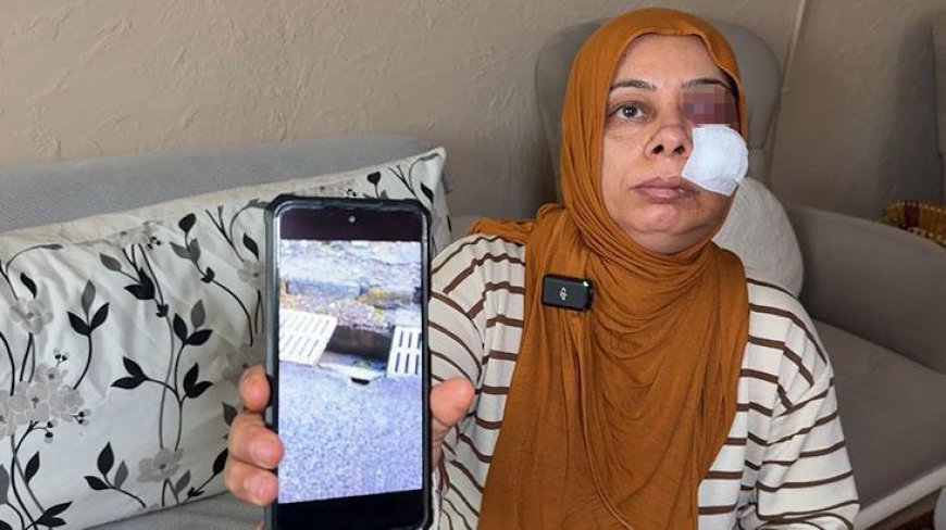 Elektrikli bisikletiyle rögara düştü! Dişleri kırıldı, yüzüne 14 dikiş atıldı