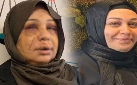 Eşinin yüzünü 60 dikiş atıldı! Kendini böyle savundu: Ben büyük bir aile katliamını önledim