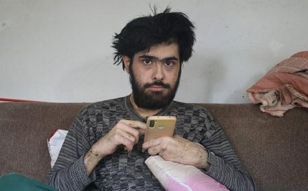 Evden çıkmayan telefon bağımlısı Barış'tan yeni haber! 25'inci yaşını böyle kutladı