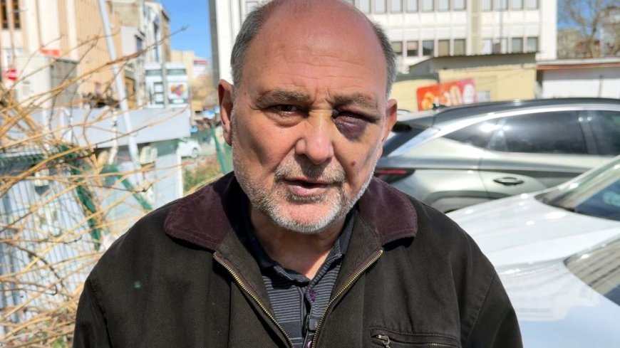 Annesinin cenazesinden dönüşte darbedildi: Çift görüyorum, iyi değilim, şikayetçiyim