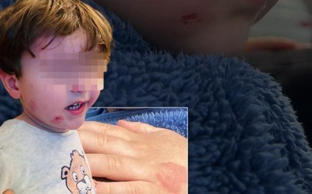 Özel kreşte skandal olay! 2,5 yaşındaki çocuk darp edildi