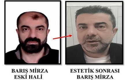 HABERLER: Ameliyat ile yüzünü değiştirmiş! 7 yıl sonra yakalandı...