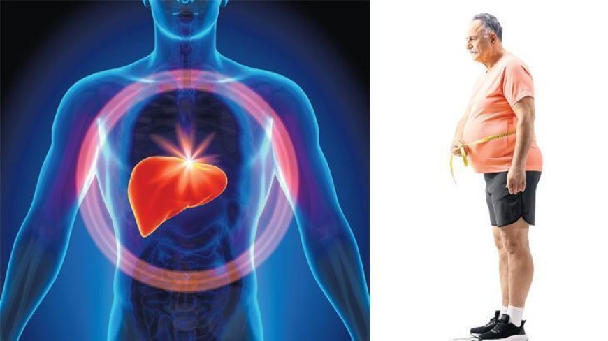 Küresel salgın: Karaciğer yağlanması