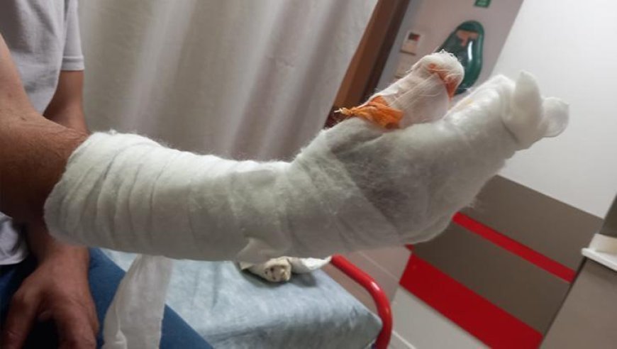 Kocaeli’de skandal iddia: Tedavi sonrası parmağı ampute edildi, kolunda metal bulundu