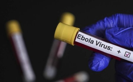 Avrupa’nın göbeğinde 'Ebola' alarmı! Hastaneler ve doktorlar harekete geçirildi