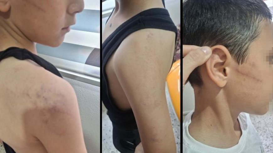 Manisa'da vicdanları sızlatan olay! Öz babadan evladına şiddet; çocuk koruma altına alındı