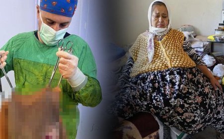 Karnından çıktı, doktorlar gözlerine inanamadı!
