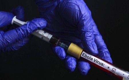 Fransa’da Ebola alarmı! 21 günlük karantina süreci başladı