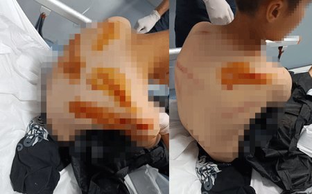 Şanlıurfa'da komşu dehşeti! 11 yaşındaki çocuğu sokak ortasında sopayla öldüresiye darbetti