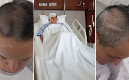 Diş ağrısı için gitti hayatı karardı. Şimdi beyninde ömür boyu cihazla yaşayacak