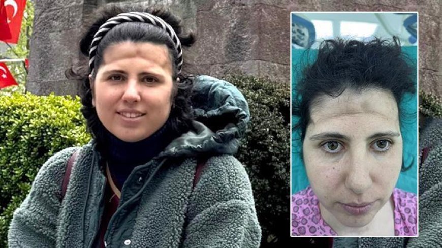 3 boyutlu teknoloji mucizesi! Alnındaki çöküklük tarih oldu