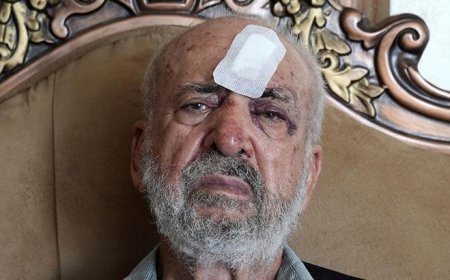 İsrail askerlerinden 80 yaşındaki Filistinliyi darbederek yaraladı