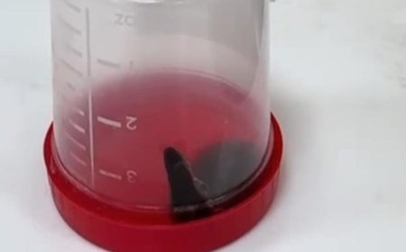 Siirt'te akılalmaz olay! Küçük çocuğun boğazından çıkanlar şaşkına çevirdi