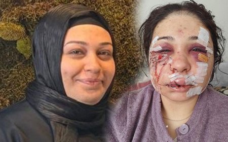 Yüzüne 60 dikiş atılmıştı! Eşini darbeden polis memuru tahliye edildi